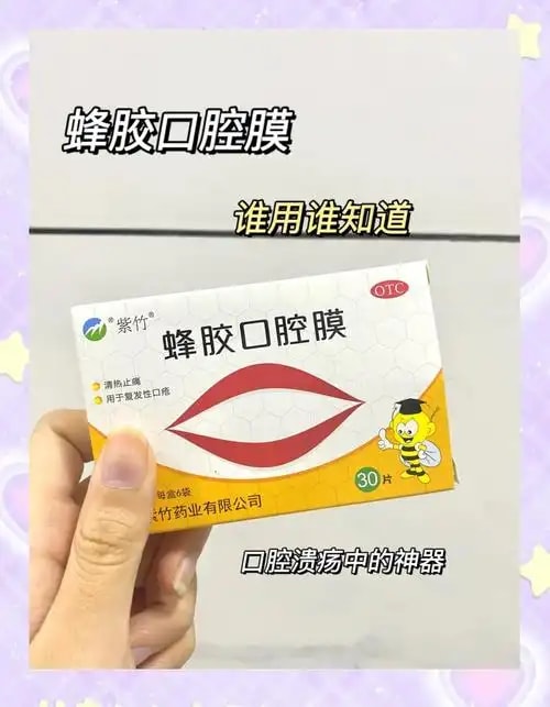 晶颜口腔溃疡贴