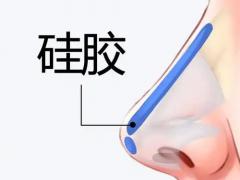 2026夏季卫生用品专题展